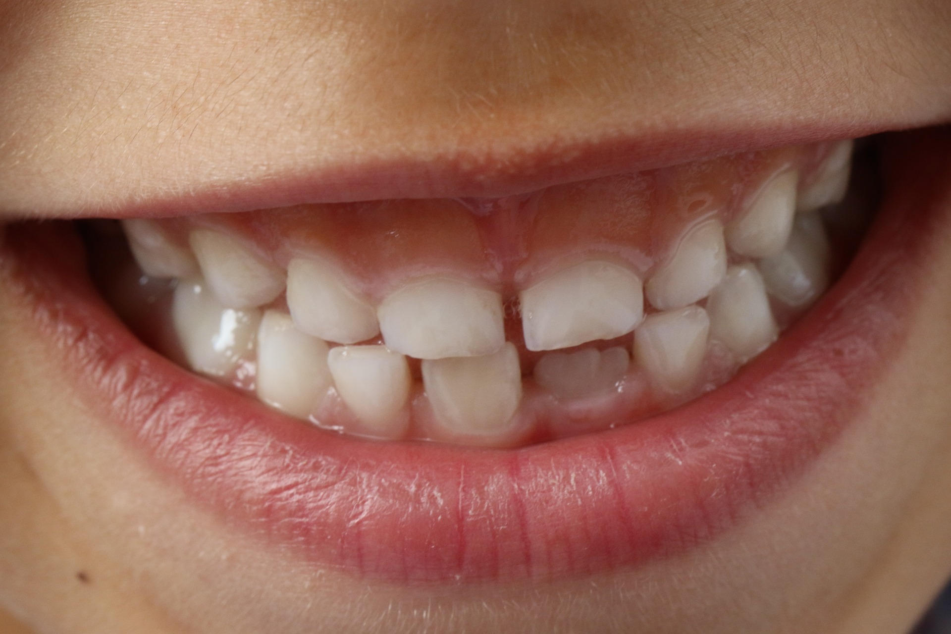 teeth smile